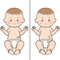 胃ろうイラスト