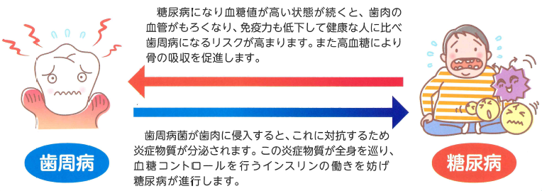 歯周病と糖尿病の関係